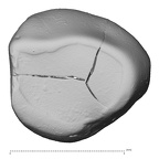 Pav14-1 Homo sapiens ULDC occlusal