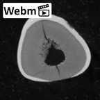 Pav18-1 Homo sapiens LLDI2 ct stack movie