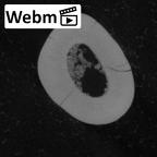 Pav19-1 Homo sapiens ULDI1 ct stack movie