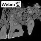 Pav2-2 Homo sapiens maxilla ct stack movie