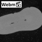 Pav24-1 Homo sapiens LRI1 ct stack movie