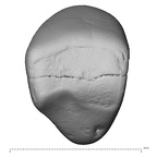 Pav25-1 Homo sapiens LRI1 occlusal