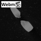 Pav25-1 Homo sapiens LRI1 ct stack movie