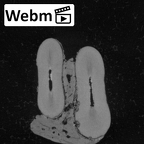 Pav26-1 Homo sapiens LI ct stack movie