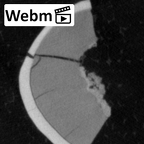 Pav27-1 Homo sapiens tooth ct stack movie