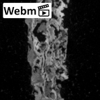 Pav3-d Homo sapiens trapezium right ct stack movie