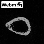 Pav3-e Homo sapiens metacarpal first right ct stack movie