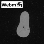 Pav5-1 Homo sapiens LRI1 ct stack movie