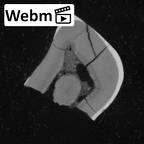Pav6-1 Homo sapiens ULDM1 ct stack movie