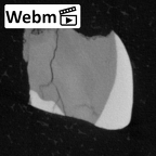 Pav8-1 Homo sapiens LRDM2 ct stack movie