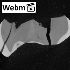 Pav9-1 Homo sapiens LRDM2 ct stack movie