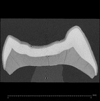EQ-H8 Homo sapiens lower molar ct slice