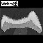 EQ-H8 Homo sapiens lower molar webm