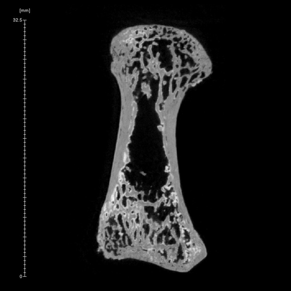 Arene Candide 2 Homo sapiens hand left first proximal phalanx ct slice