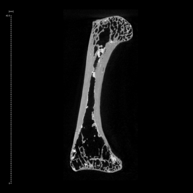 Arene Candide 2 Homo sapiens hand left fourth proximal phalanx ct slice