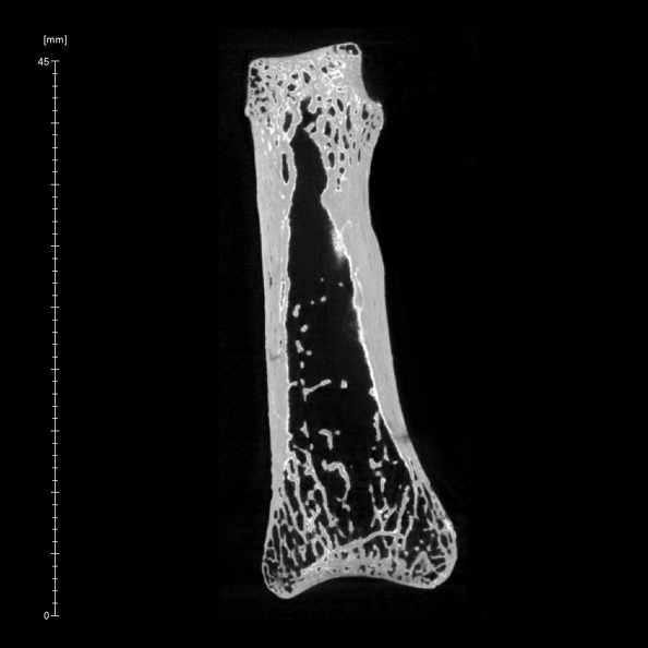 Arene Candide 2 Homo sapiens hand right third proximal phalanx ct slice