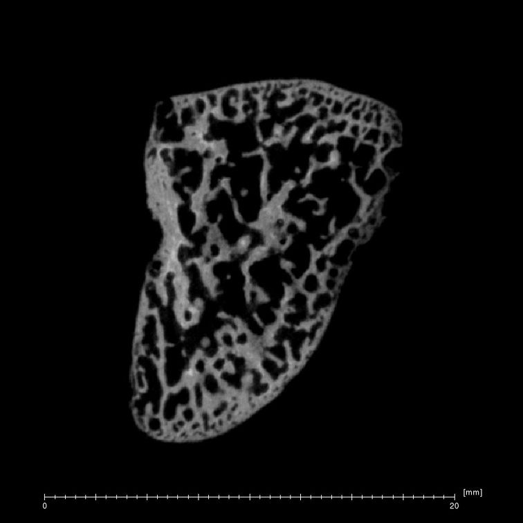 Arene Candide 2 Homo sapiens right hamate ct slice