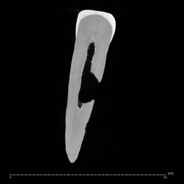 La Fate 15 Homo neanderthalensis LLC ct slice