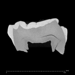 La Fate 6 Homo neanderthalensis LRM ct slice