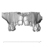 La Quina H18 Homo neanderthalensis maxilla anterior