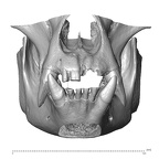 CCEC-50002625 Gorilla gorilla dentition anterior