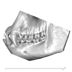 CCEC-50002625 Gorilla gorilla dentition lateral