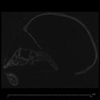 CCEC-50001746 Pan skull ct slice