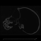 CCEC-50001754 Pan troglodytes skull ct slice