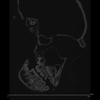 CCEC-50001759 Pan troglodytes skull ct slice