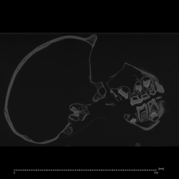 CCEC-50001795 Pan troglodytes skull ct slice