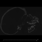 CCEC-50001796 Pan troglodytes skull ct slice