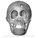 CCEC-50001801 Pan skull anterior