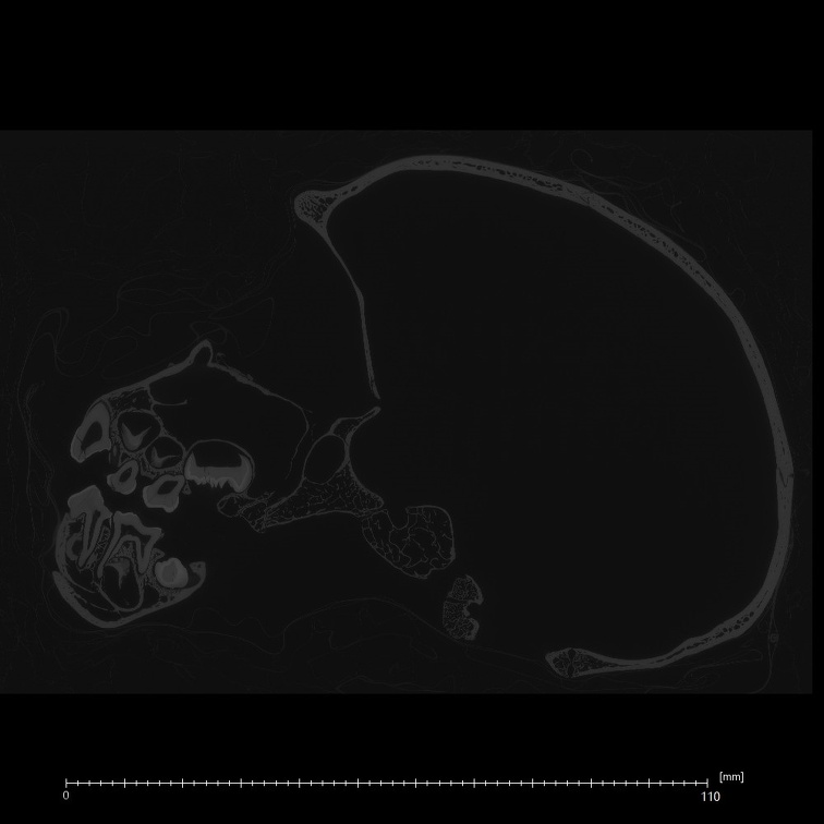 CCEC-50002604 Pan troglodytes skull ct slice