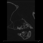 CCEC-50003363 Pan troglodytes skull ct slice
