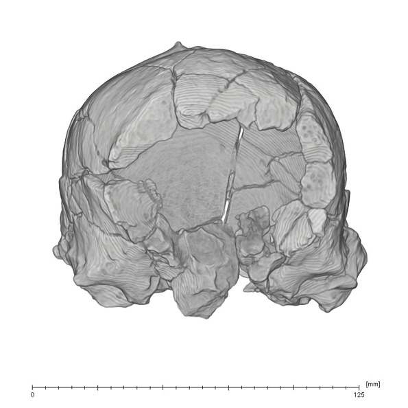 KNM-ER 1805 Homo habilis cranium medical ct anterior