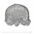 KNM-ER 1805 Homo habilis cranium medical ct anterior