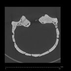 KNM-ER 1805 Homo habilis cranium medical ct ct slice