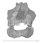 KNM-ER 1805 H. habilis maxilla mandible medical ct