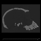 KNM-ER-1813 Homo habilis cranium medical ct ct slice