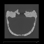 KNM-ER 3733 Homo erectus cranium medical ct ct slice