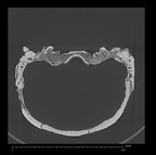 KNM-ER 3833 Homo erectus cranium medical ct ct slice