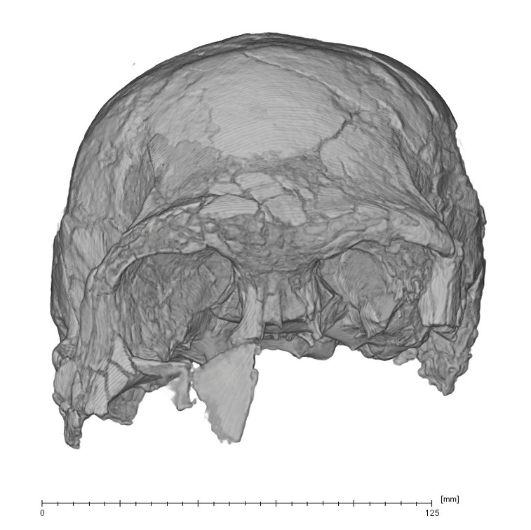 KNM-ER 3883 Homo erectus cranium medical ct anterior