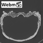 KNM-ER 3883 Homo erectus cranium medical ct stack movie