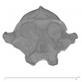 KNM-ER 406 P. boisei cranium medical ct anterior