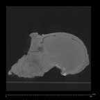 KNM-ER 406 P. boisei cranium medical ct ct slice