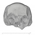 KNM-ES 11693 Homo sp. cranium medical ct anterior