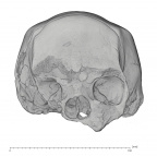 KNM-ES 11693 Homo sp. cranium medical ct