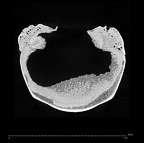 KNM-ES 11693 Homo sp. cranium medical ct ct slice
