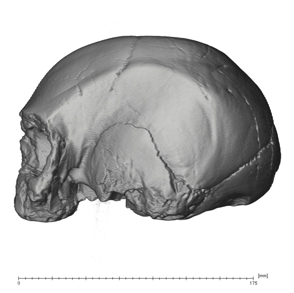 KNM-ES 11693 Homo sp. cranium medical ct lateral