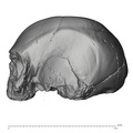 KNM-ES 11693 Homo sp. cranium medical ct lateral